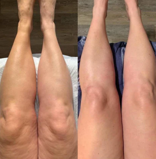 Bottes de Massage Air Wave